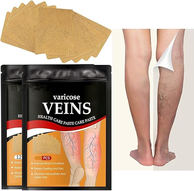 Varicose Veins Treatment Patch,12 PCS